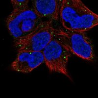 Anti-TECPR1 antibody produced in rabbit 