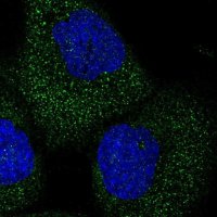 Anti-TELO2 antibody produced in rabbit 