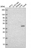 Anti-TFCP2 antibody produced in rabbit HPA070247-100UL