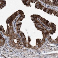Anti-THEM6 antibody produced in rabbit 