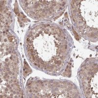 Anti-TIGAR antibody produced in rabbit 