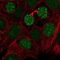 Anti-TIGD1 antibody produced in rabbit 