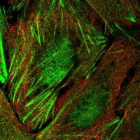 Anti-TIGD6 antibody produced in rabbit 