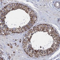 Anti-TIMM10 antibody produced in rabbit 