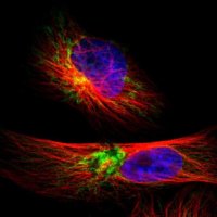 Anti-TIMM9 antibody produced in rabbit 