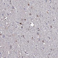 Anti-TK2 antibody produced in rabbit 
