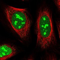 Anti-TMA16 antibody produced in rabbit HPA041571-100UL