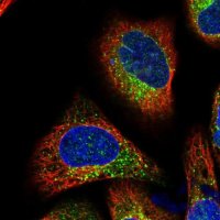 Anti-TMC7 antibody produced in rabbit 