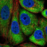Anti-TMEM121 antibody produced in rabbit 