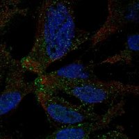 Anti-TMEM178A antibody produced in rabbit 