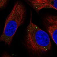 Anti-TMEM181 antibody produced in rabbit 