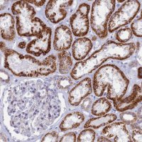 Anti-TMEM206 antibody produced in rabbit 