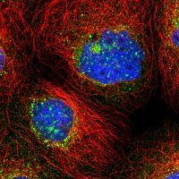 Anti-TMEM209 antibody produced in rabbit 