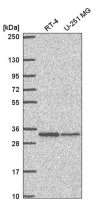 Anti-TMEM81 antibody produced in rabbit 