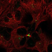 Anti-TMEM86B antibody produced in rabbit 