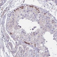 Anti-TMEM8C antibody produced in rabbit 