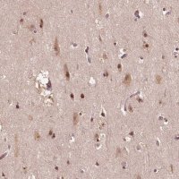Anti-TMX2 antibody produced in rabbit HPA063763-100UL