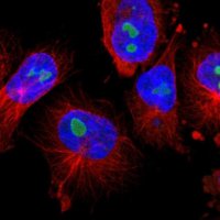 Anti-TNFAIP1 antibody produced in rabbit 