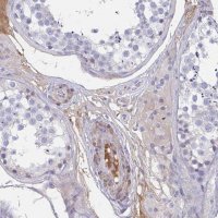 Anti-TNFAIP6 antibody produced in rabbit 