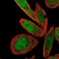 Anti-TNIP2 antibody produced in rabbit 
