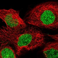 Anti-TNKS antibody produced in rabbit 
