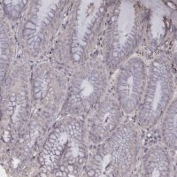 Anti-TNNI1 antibody produced in rabbit 