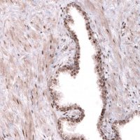 Anti-TNRC6A antibody produced in rabbit 