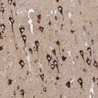 Anti-TOMM20 antibody produced in rabbit 