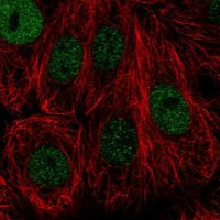 Anti-TONSL antibody produced in rabbit 