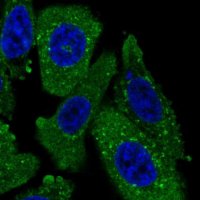 Anti-TPD52L2 antibody produced in rabbit HPA047489-100UL