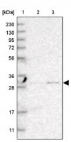 Anti-TPMT antibody produced in rabbit 