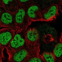 Anti-TPRG1 antibody produced in rabbit 
