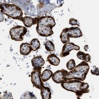 Anti-TRAK2 antibody produced in rabbit 