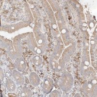 Anti-TRANK1 antibody produced in rabbit 