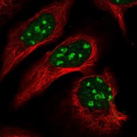 Anti-TRDMT1 antibody produced in rabbit 