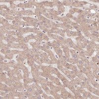Anti-TRIAP1 antibody produced in rabbit 