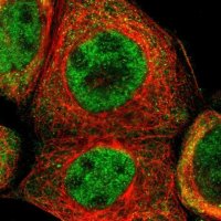 Anti-TRIB2 antibody produced in rabbit 