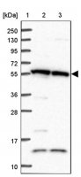 Anti-TRIM27 antibody produced in rabbit 