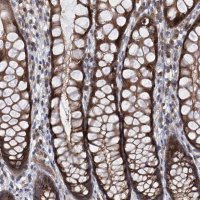 Anti-TRIM38 antibody produced in rabbit 