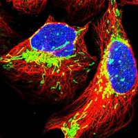 Anti-TRPT1 antibody produced in rabbit 
