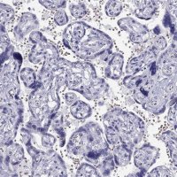 Anti-TSHB antibody produced in rabbit 