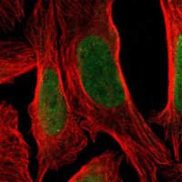 Anti-TSHZ3 antibody produced in rabbit 