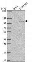 Anti-TSR1 antibody produced in rabbit 