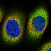 Anti-TTC1 antibody produced in rabbit HPA036557-100UL