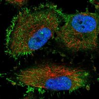 Anti-TTC17 antibody produced in rabbit 