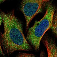 Anti-TTC31 antibody produced in rabbit 