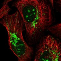 Anti-TTLL1 antibody produced in rabbit 