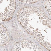 Anti-TTLL4 antibody produced in rabbit 