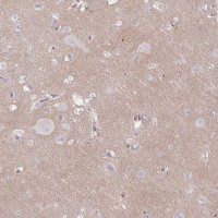 Anti-TTYH1 antibody produced in rabbit HPA050655-100UL