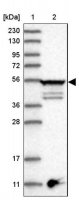 Anti-TUBE1 antibody produced in rabbit HPA032073-100UL